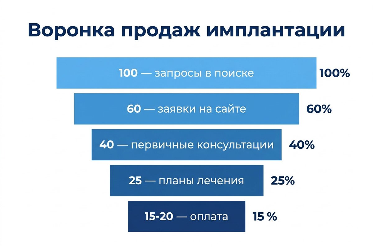 Воронка продаж имплантации — статистика конверсии